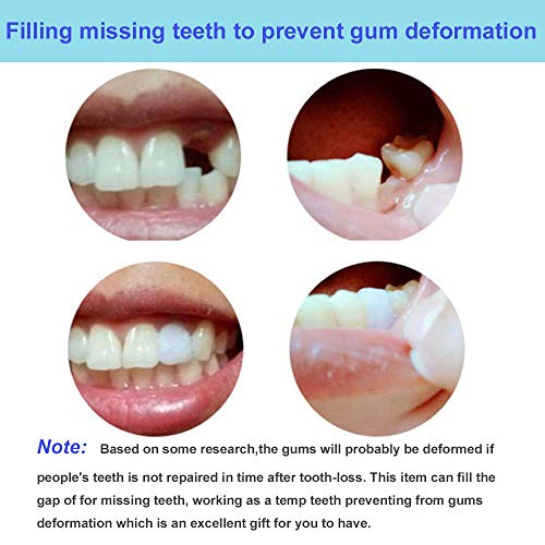 ערכת תיקון שיניים, שיניים כוזבות מעוצבות חרוזים מתאימים תרמיים, פער שיניים שבור למילוי זמני לחיוך מיידי ובטוח, דבק תותבות